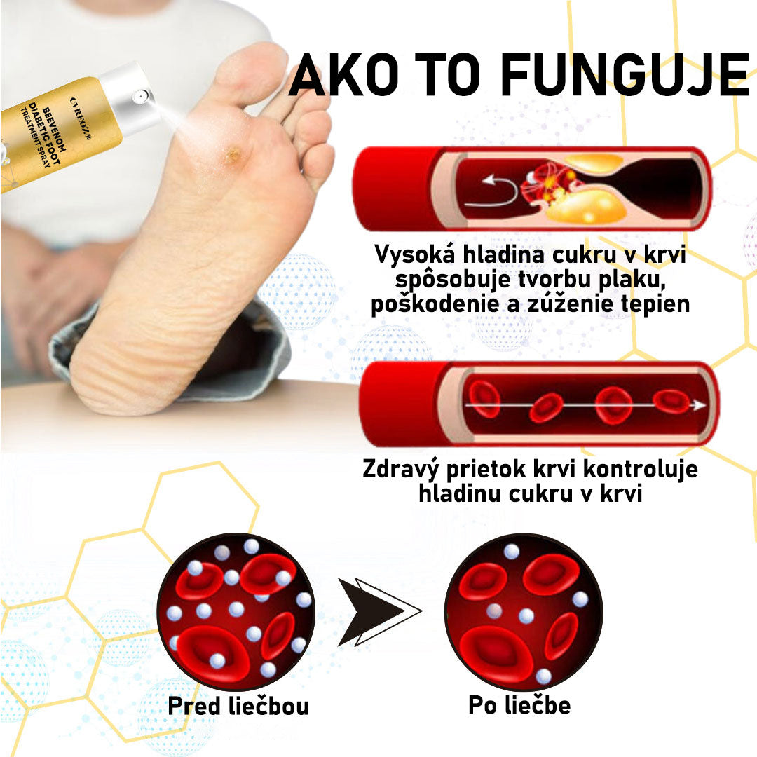 CVREOZ® Bee Venom Sprej na liečbu diabetickej nohy 🔥 Akcia na obmedzený čas – 60 % zľava 🔥