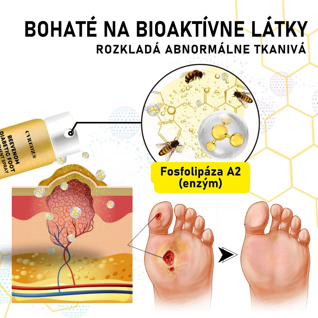CVREOZ® Bee Venom Sprej na liečbu diabetickej nohy 🔥 Akcia na obmedzený čas – 60 % zľava 🔥