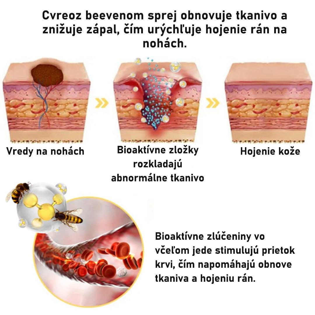 CVREOZ® Bee Venom Sprej na liečbu diabetickej nohy 🔥 Akcia na obmedzený čas – 60 % zľava 🔥