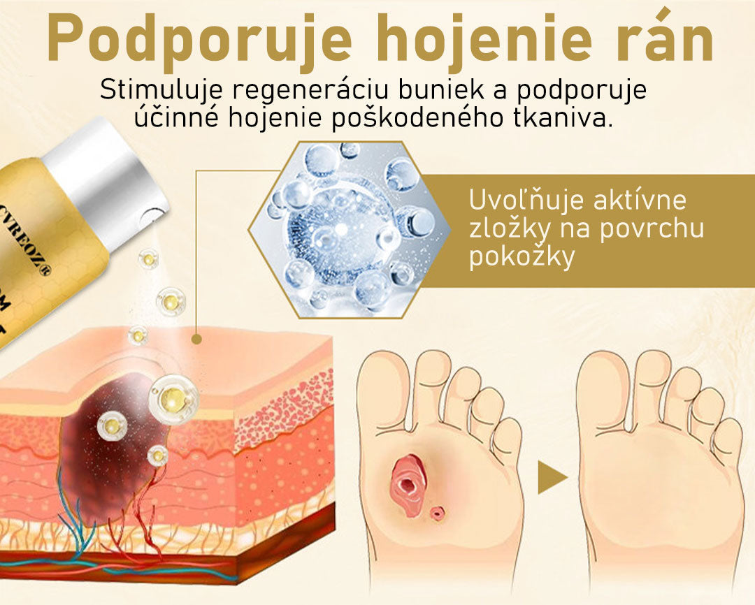 CVREOZ® Bee Venom Sprej na liečbu diabetickej nohy 🔥 Akcia na obmedzený čas – 60 % zľava 🔥