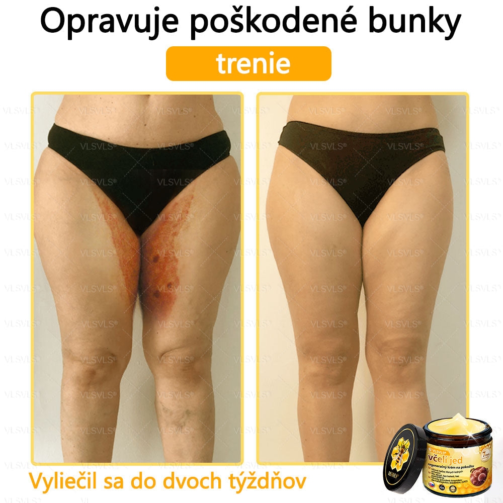 VLSVLS™ Obnovujúci krém na pleť so včelím jedom💥💥