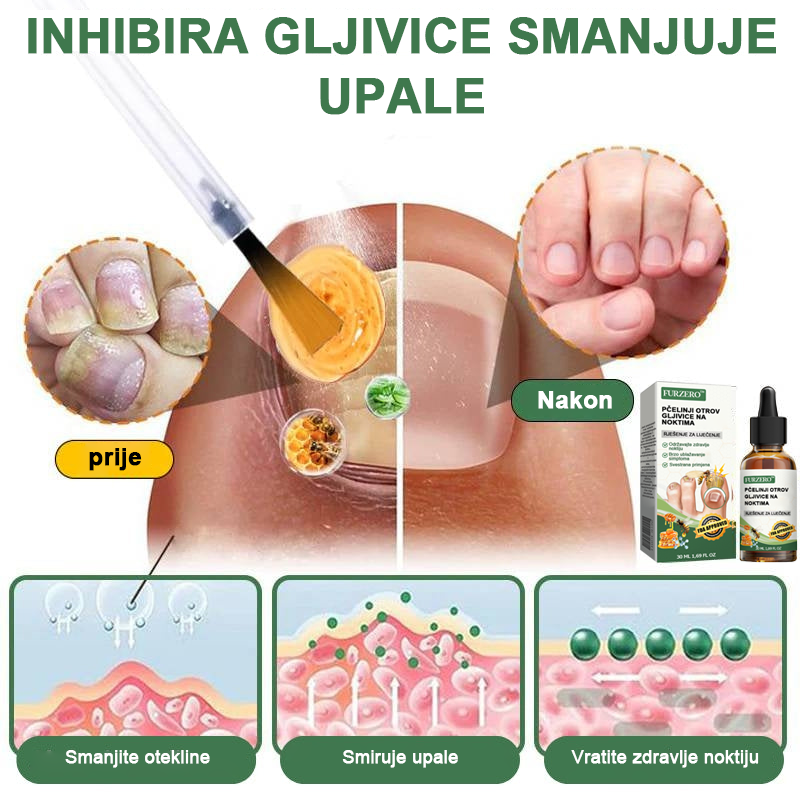 👩⚕️Furzero™ Ošetrujúce sérum proti včelímu jedu na nechty
