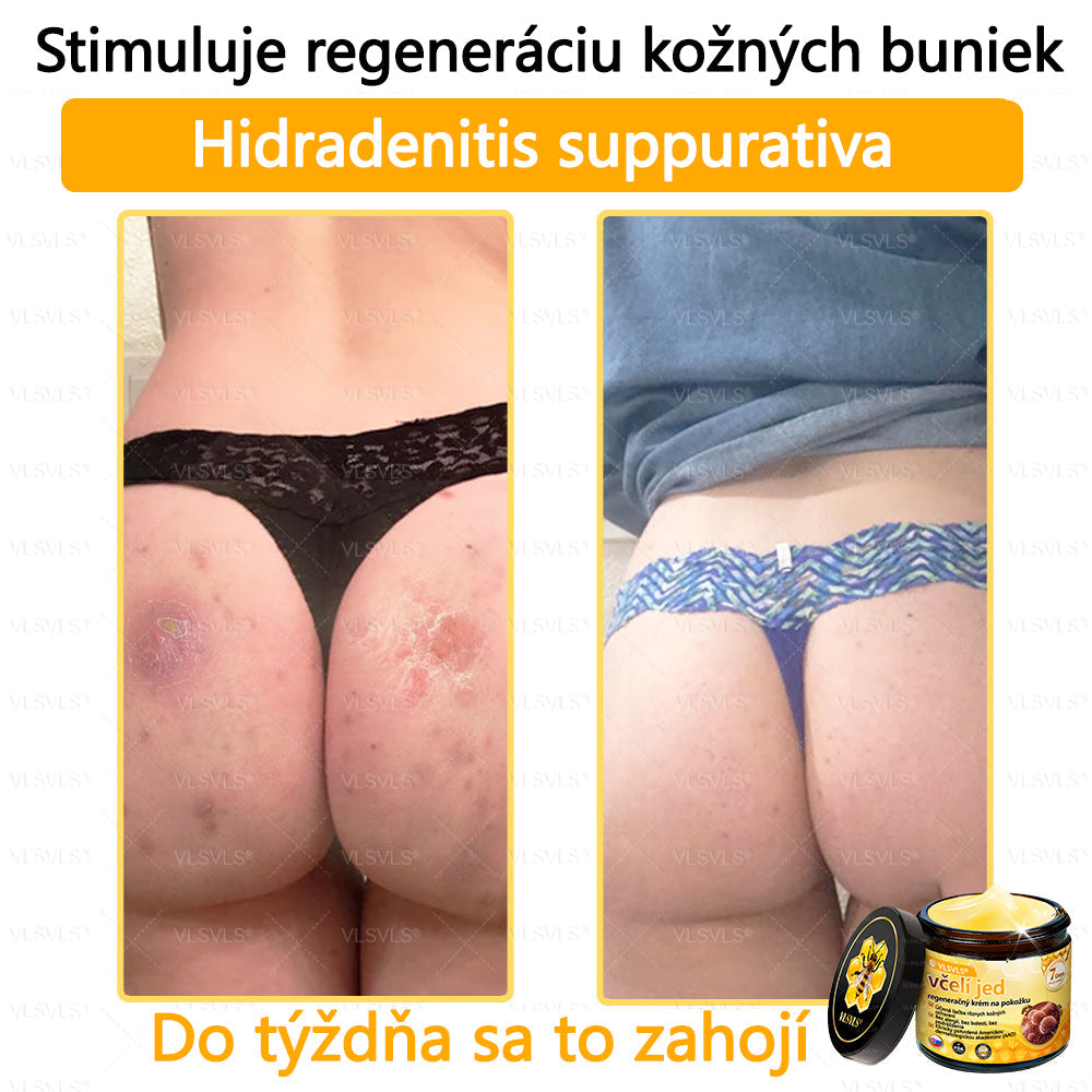 VLSVLS™ Obnovujúci krém na pleť so včelím jedom💥💥
