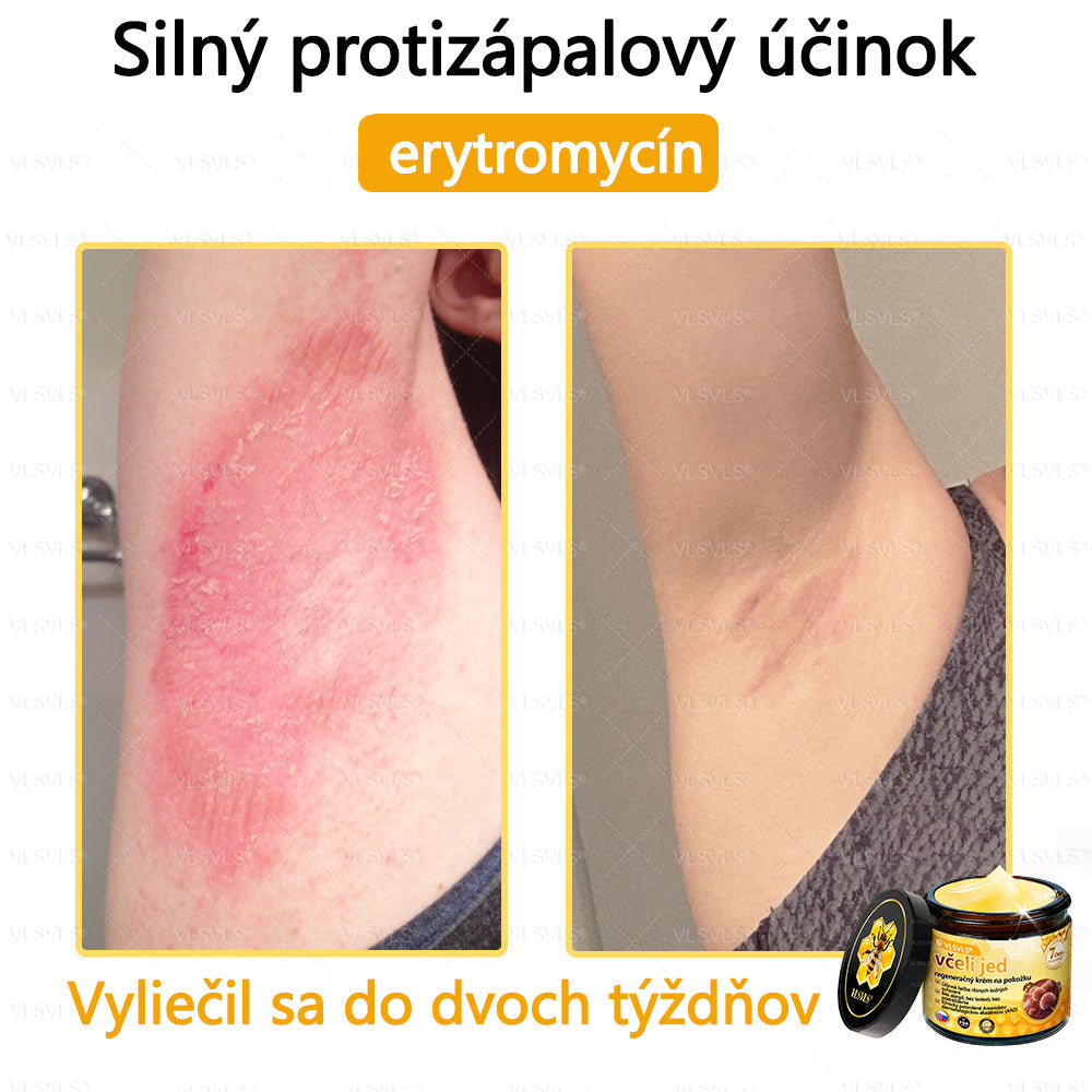 VLSVLS™ Obnovujúci krém na pleť so včelím jedom💥💥