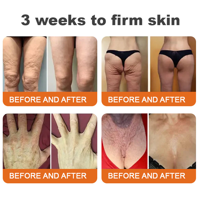 ✨Flysmus™ Botox Spevňujúce sérum so včelím jedom🔥POSLEDNÝ DEŇ 70% ZĽAVA