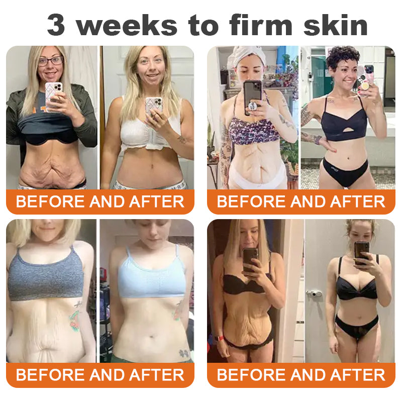 ✨Flysmus™ Botox Spevňujúce sérum so včelím jedom🔥POSLEDNÝ DEŇ 70% ZĽAVA