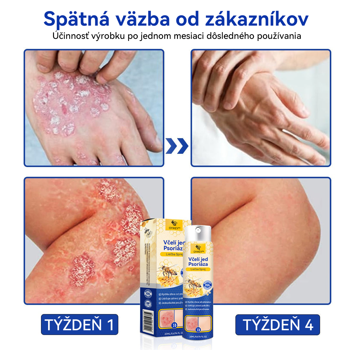 𝐎𝐘𝐈𝐊𝐄𝐘™ 𝐕č𝐞𝐥í 𝐣𝐞𝐝 𝐏𝐬𝐨𝐫𝐢á𝐳𝐚 𝐋𝐢𝐞č𝐛𝐚 𝐒𝐩𝐫𝐞𝐣 (🔥 60% z posledného dňa nákupu balíka 🔥)🏆