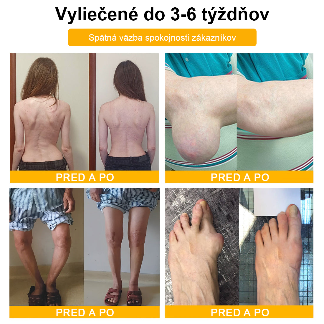 ArthroFree™ Krém na bolesti kĺbov s včelím jedom na hojenie kostí(🐝odporúča AAOS)