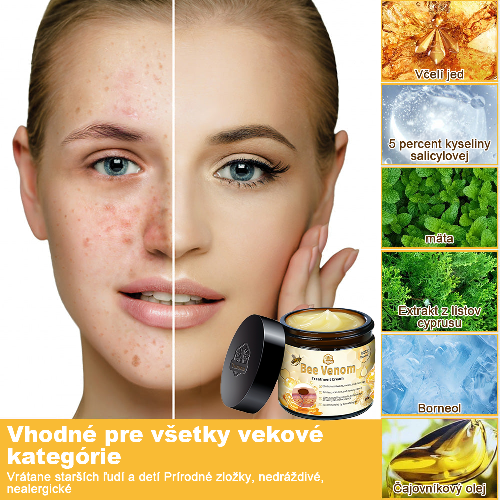 🏵️Turonu™ Krém na ošetrenie pokožky včelím jedom (odporúčané AAD)