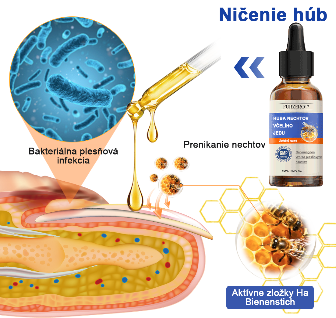 🐝Furzero™ Včelí jed na plesne na nechtoch: kompletné riešenie plesní na nechtoch 🌟👣