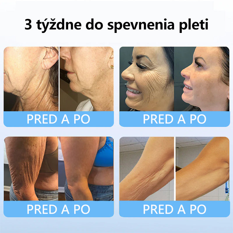 Flysmus™ Kolagénové peptidy SPEVŇUJÚCE SÉRUM v tyčinke 🇸🇰 Certifikované Slovenským ústavom hygieny (SÚH) a Slovenskou dermatologickou spoločnosťou (SDS), zaručujúce najvyššiu kvalitu a bezpečnosť pre vašu pleť.