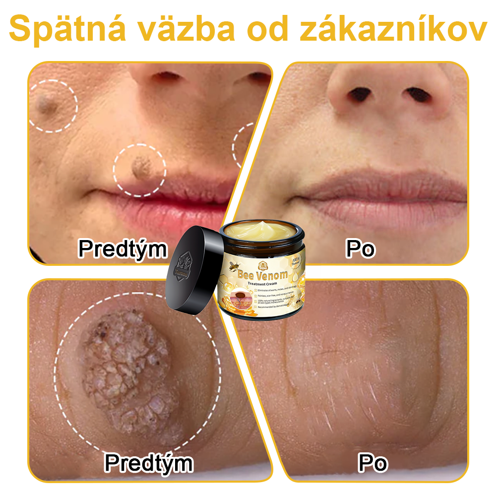 🏵️Turonu™ Krém na ošetrenie pokožky včelím jedom (odporúčané AAD)