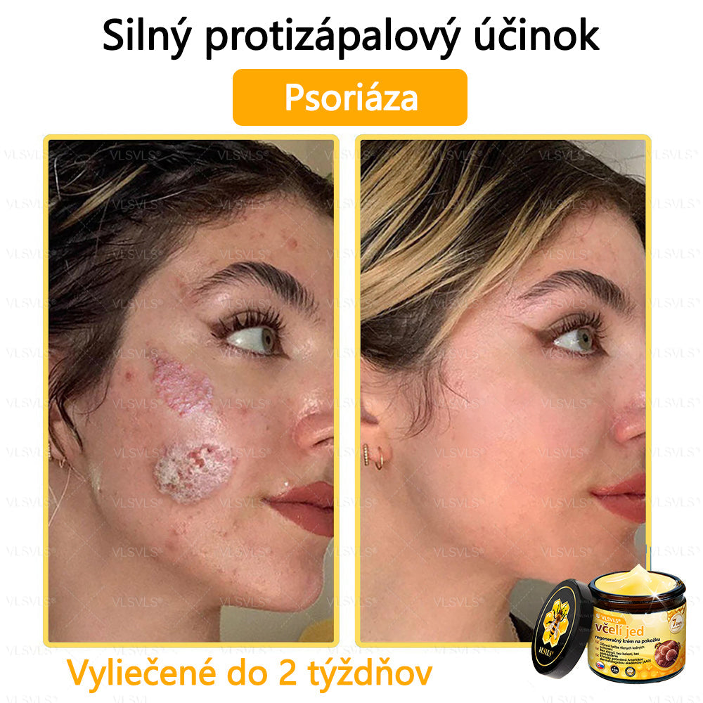 VLSVLS™ Obnovujúci krém na pleť so včelím jedom💥💥