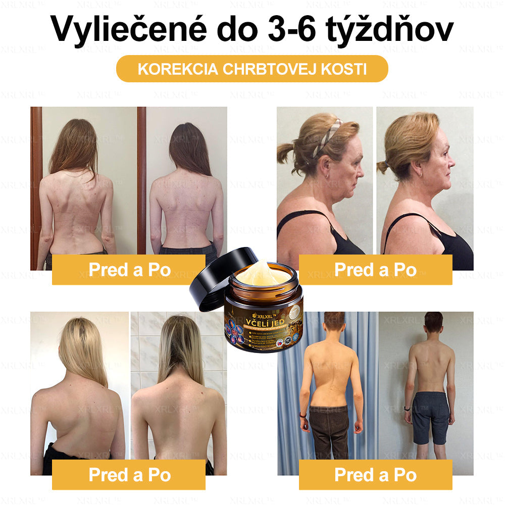 XRLXRL™ Krém na úľavu od bolesti a hojenie kostí s včelím jedom ✨🌸(Špeciálne pre starších dospelých a odporúčaný 🧑⚕️AAOS)