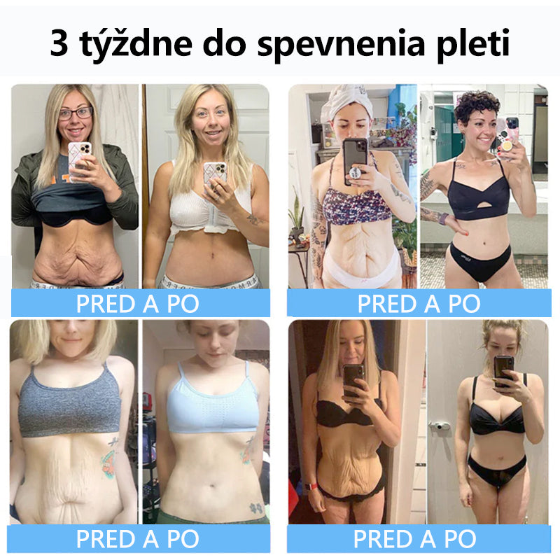 Flysmus™ Kolagénové peptidy SPEVŇUJÚCE SÉRUM v tyčinke 🇸🇰 Certifikované Slovenským ústavom hygieny (SÚH) a Slovenskou dermatologickou spoločnosťou (SDS), zaručujúce najvyššiu kvalitu a bezpečnosť pre vašu pleť.