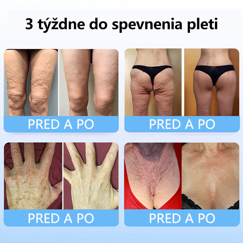 Flysmus™ Kolagénové peptidy SPEVŇUJÚCE SÉRUM v tyčinke 🇸🇰 Certifikované Slovenským ústavom hygieny (SÚH) a Slovenskou dermatologickou spoločnosťou (SDS), zaručujúce najvyššiu kvalitu a bezpečnosť pre vašu pleť.