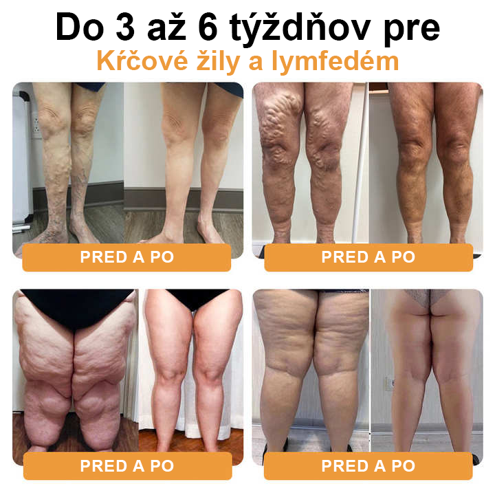 🔥JOSFIT™ Ultradźwiękowy detoks tłuszczowy i daleką podczerwień równoważąca poziom cukru we krwi opaska na nadgarstek - Energy Balance Specjalna oferta ograniczona czasowo