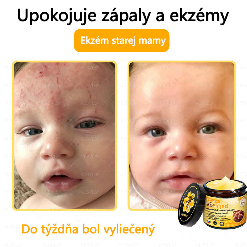 VLSVLS™ Obnovujúci krém na pleť so včelím jedom💥💥