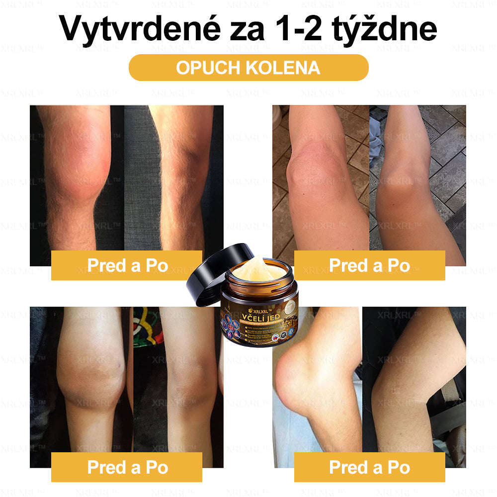 XRLXRL™ Krém na úľavu od bolesti a hojenie kostí s včelím jedom ✨🌸(Špeciálne pre starších dospelých a odporúčaný 🧑⚕️AAOS)