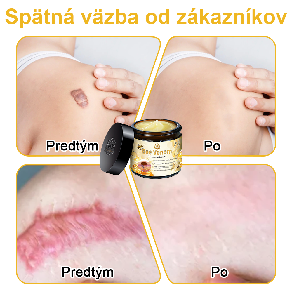 🏵️Turonu™ Krém na ošetrenie pokožky včelím jedom (odporúčané AAD)