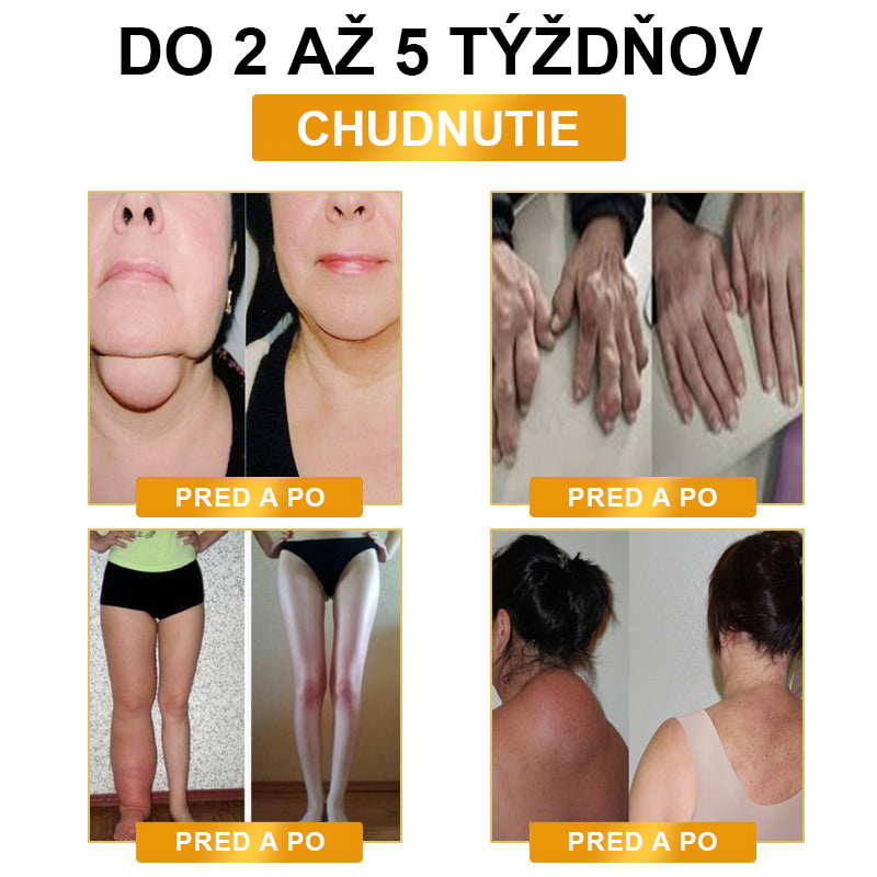 🔥JOSFIT™ Ultradźwiękowy detoks tłuszczowy i daleką podczerwień równoważąca poziom cukru we krwi opaska na nadgarstek - Energy Balance Specjalna oferta ograniczona czasowo