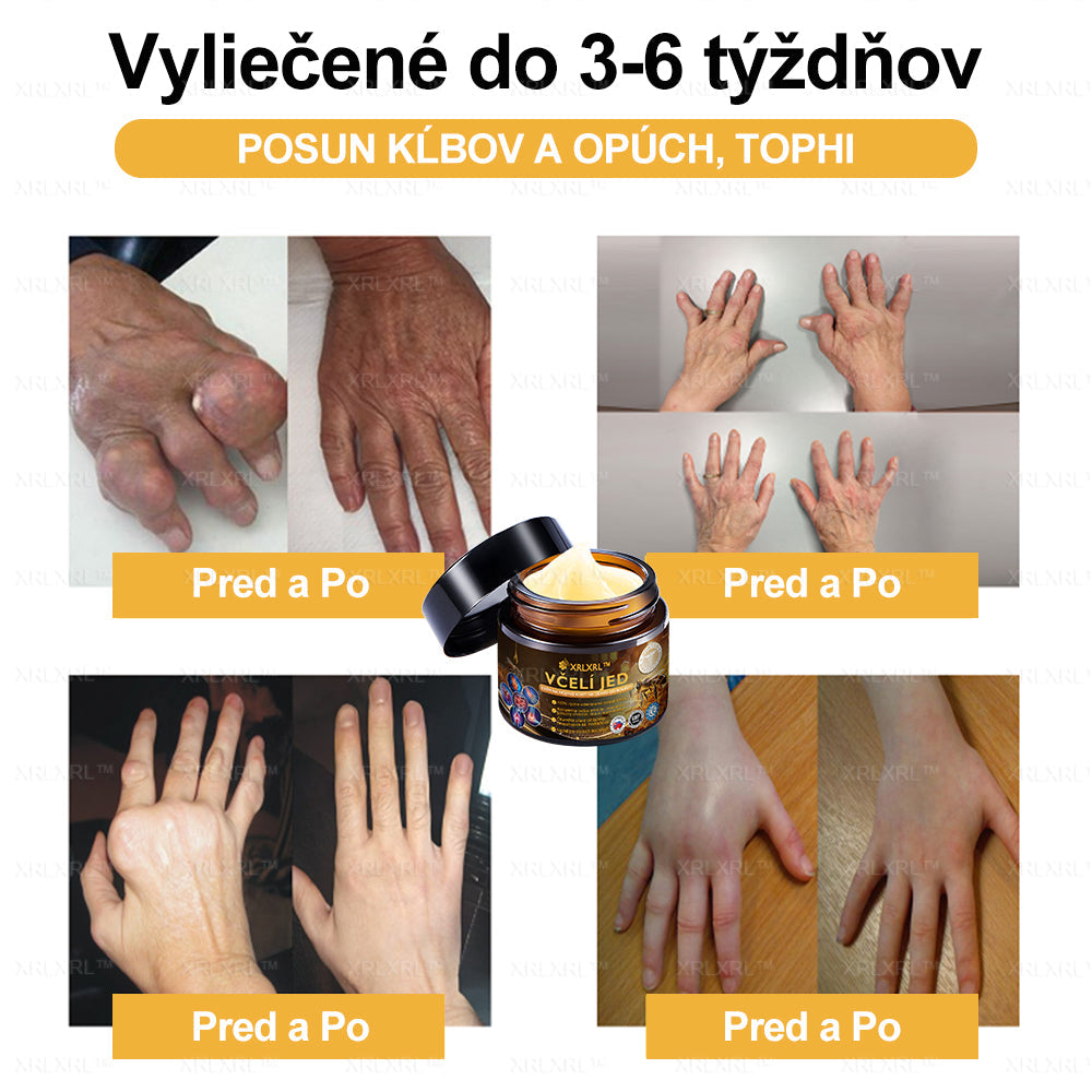 XRLXRL™ Krém na úľavu od bolesti a hojenie kostí s včelím jedom ✨🌸(Špeciálne pre starších dospelých a odporúčaný 🧑⚕️AAOS)
