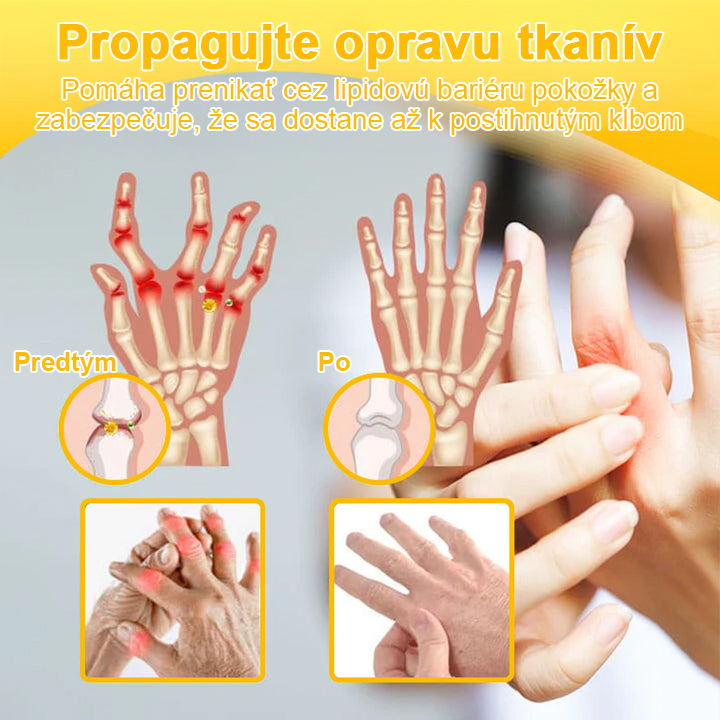 ArthroFree™ Krém na bolesti kĺbov s včelím jedom na hojenie kostí(🐝odporúča AAOS)