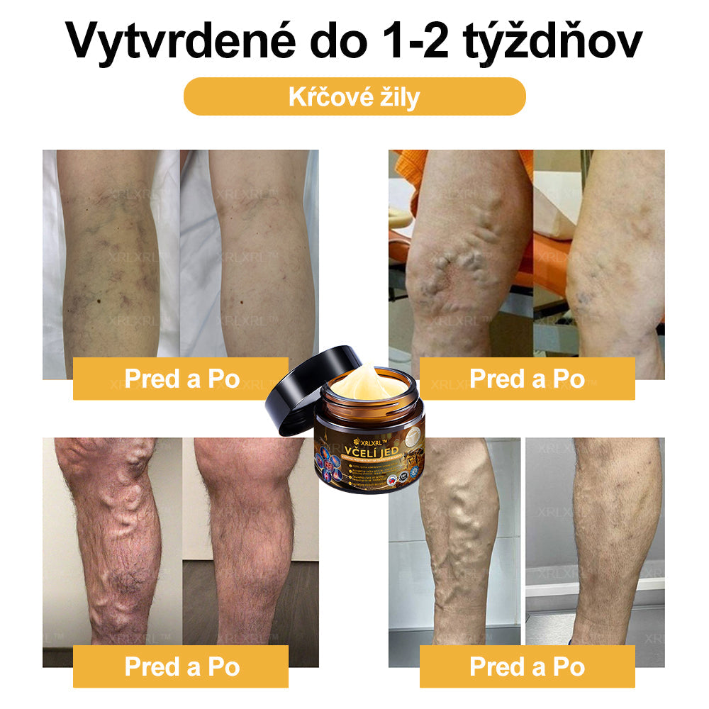 XRLXRL™ Krém na úľavu od bolesti a hojenie kostí s včelím jedom ✨🌸(Špeciálne pre starších dospelých a odporúčaný 🧑⚕️AAOS)