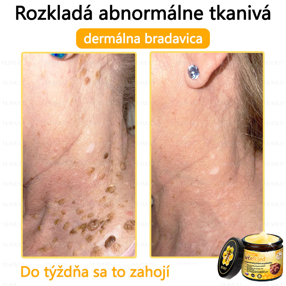 VLSVLS™ Obnovujúci krém na pleť so včelím jedom💥💥