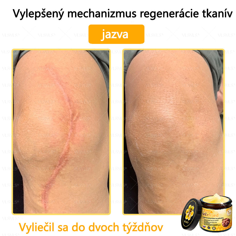 VLSVLS™ Obnovujúci krém na pleť so včelím jedom💥💥