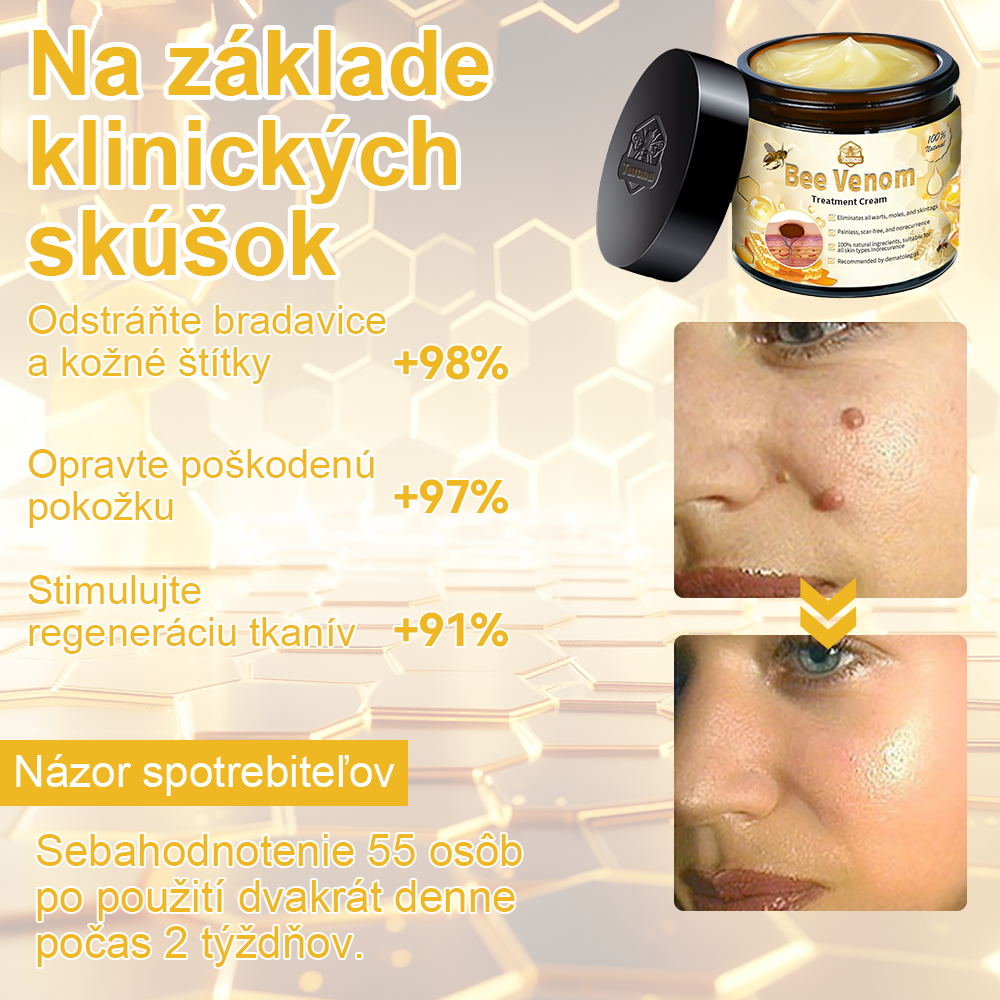 🏵️Turonu™ Krém na ošetrenie pokožky včelím jedom (odporúčané AAD)