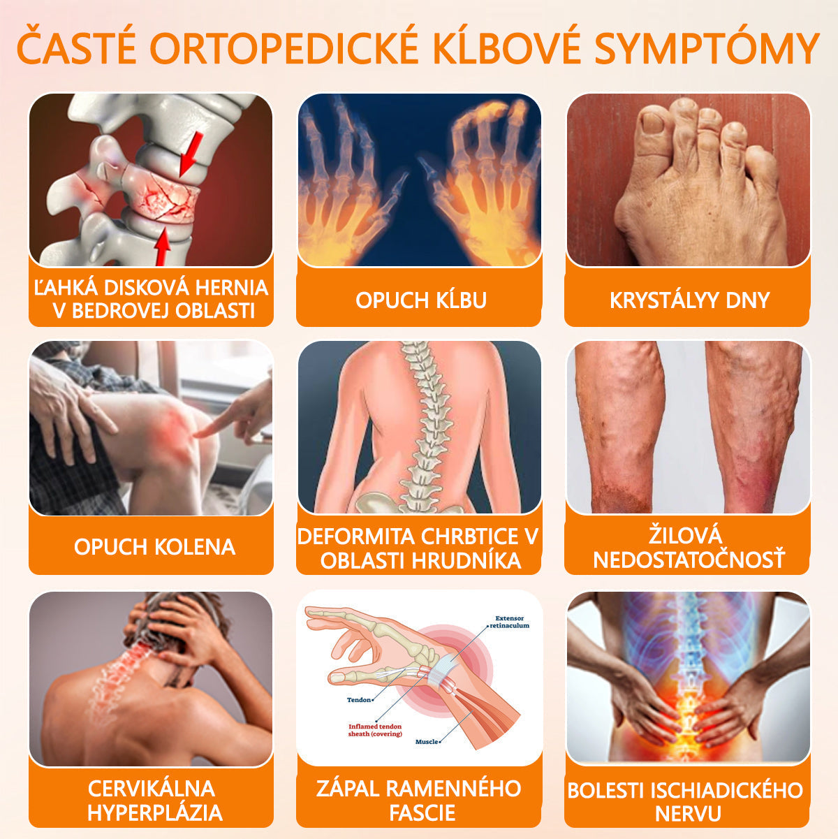 ADNOON® Krém na hojenie kostí s botulotoxínom a včelím jedom ⭐👨⚕️Schválené Slovenskou spoločnosťou ortopedie a traumatológie (SOTS)