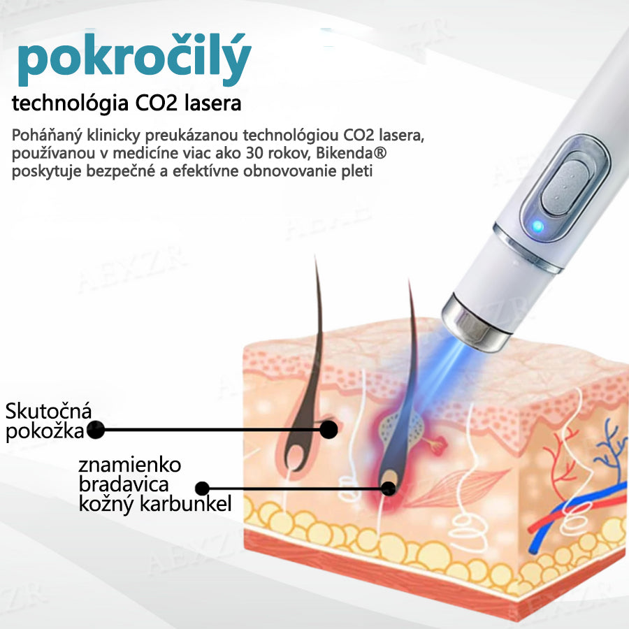 Bikenda® Neinvazívne laserové pero na odstránenie znamienok a bradavíc