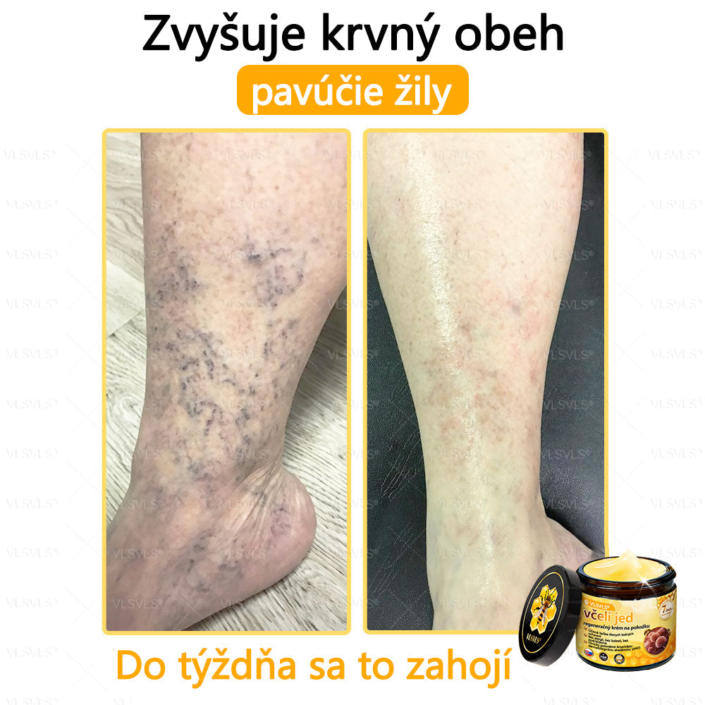 VLSVLS™ Obnovujúci krém na pleť so včelím jedom💥💥
