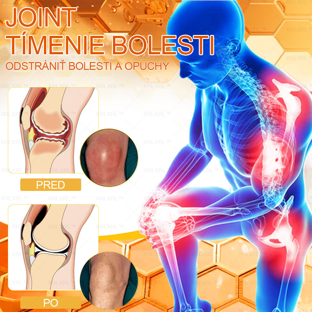 XRLXRL™ Krém na úľavu od bolesti a hojenie kostí s včelím jedom ✨🌸(Špeciálne pre starších dospelých a odporúčaný 🧑⚕️AAOS)