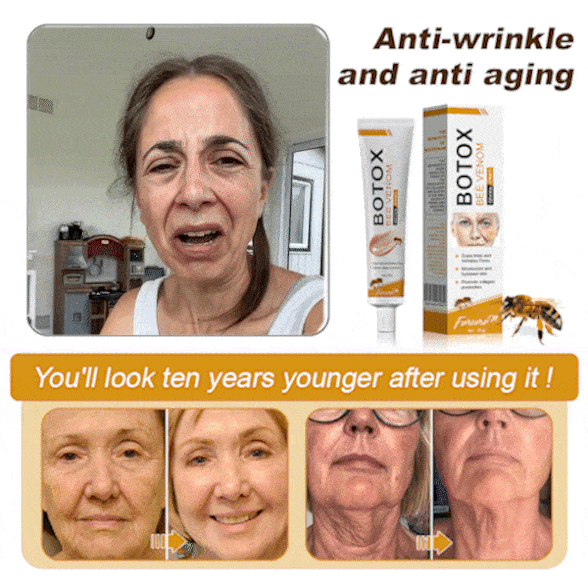 (🌷Vyrobené a odoslané zo Slovenska✅) Krém na vyhladenie vrások Furzero™ Botox s včelím jedom – POSLEDNÝ DEŇ 70% ZĽAVA