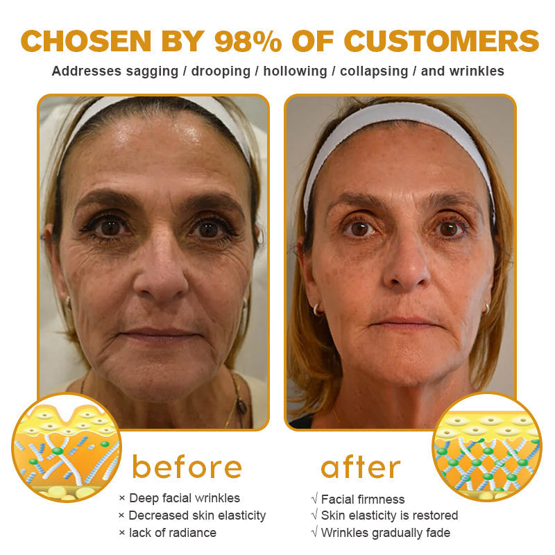 (🌷Vyrobené a odoslané zo Slovenska✅) Krém na vyhladenie vrások Furzero™ Botox s včelím jedom – POSLEDNÝ DEŇ 70% ZĽAVA