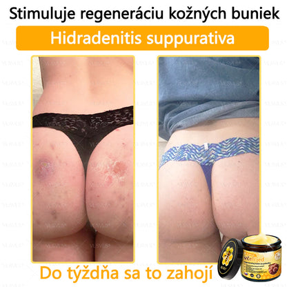 VLSVLS™ Obnovujúci krém na pleť so včelím jedom💥💥