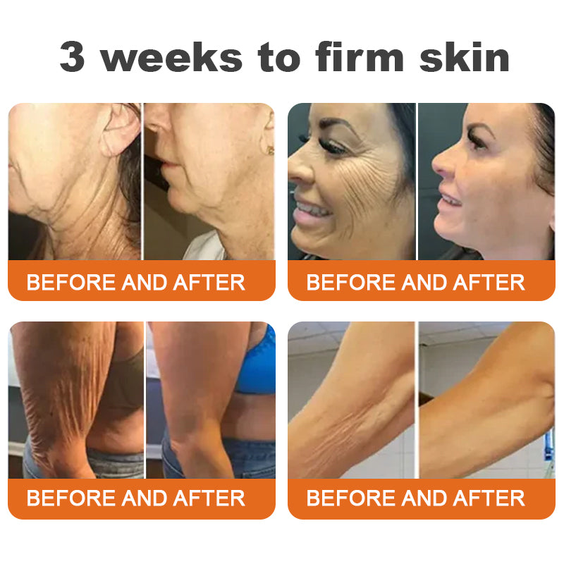 ✨Flysmus™  Botox  Spevňujúce sérum so včelím jedom🔥POSLEDNÝ DEŇ 70% ZĽAVA