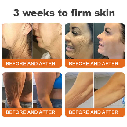 ✨Flysmus™  Botox  Spevňujúce sérum so včelím jedom🔥POSLEDNÝ DEŇ 70% ZĽAVA