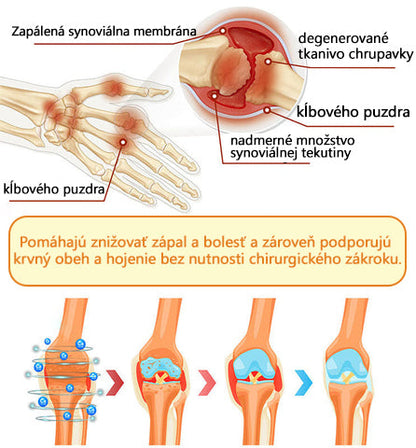 ADNOON® Krém na hojenie kostí s botulotoxínom a včelím jedom ⭐👨‍⚕️Schválené Slovenskou spoločnosťou ortopedie a traumatológie (SOTS)