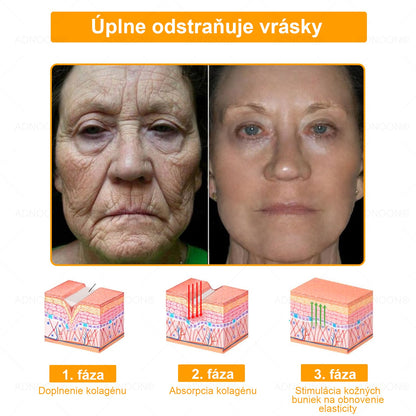 ADNOON® 🌼 Denný krém na rýchlu regeneráciu pokožky – odporúčaný Slovenskou dermatologickou spoločnosťou (SDS)👨‍⚕️.