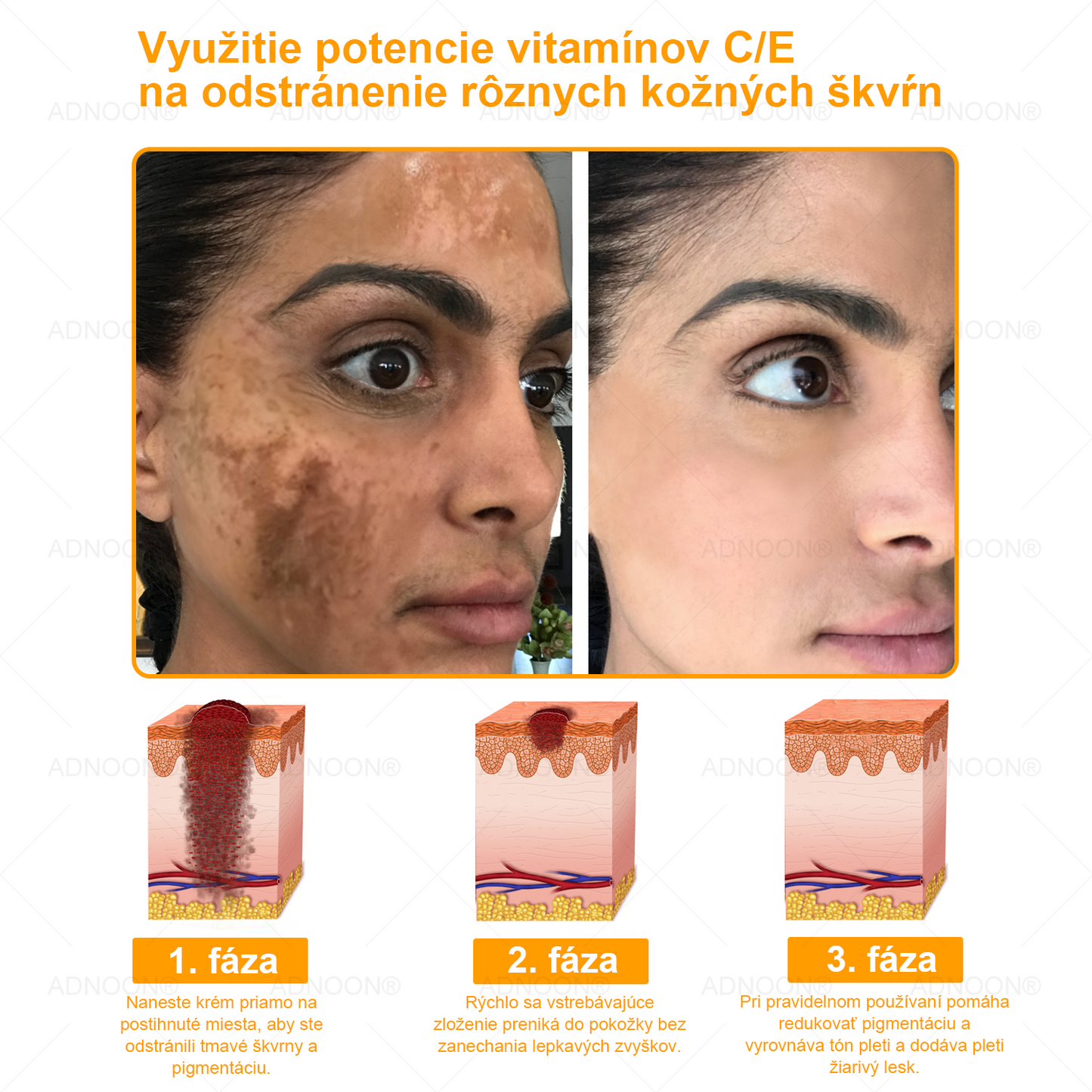 ADNOON® 🌼 Denný krém na rýchlu regeneráciu pokožky – odporúčaný Slovenskou dermatologickou spoločnosťou (SDS)👨‍⚕️.