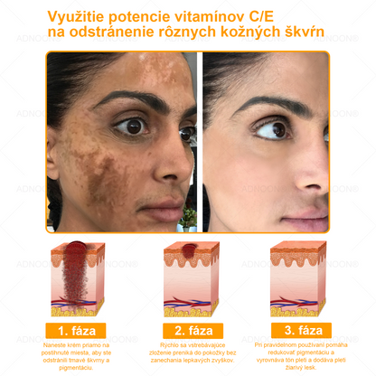 ADNOON® 🌼 Denný krém na rýchlu regeneráciu pokožky – odporúčaný Slovenskou dermatologickou spoločnosťou (SDS)👨‍⚕️.