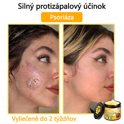 VLSVLS™ Obnovujúci krém na pleť so včelím jedom💥💥