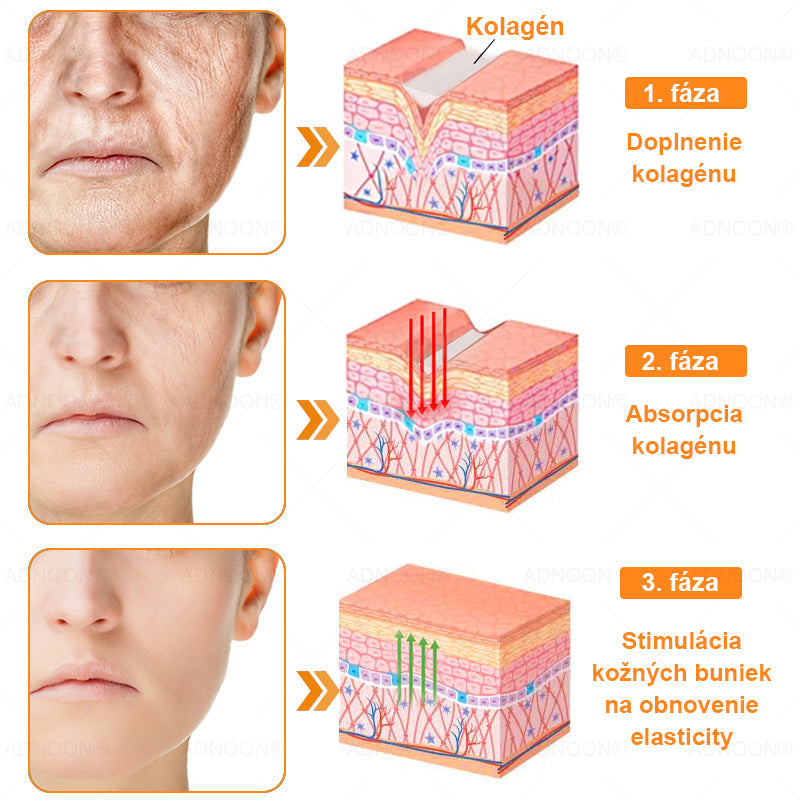 ADNOON® 🌼 Denný krém na rýchlu regeneráciu pokožky – odporúčaný Slovenskou dermatologickou spoločnosťou (SDS)👨‍⚕️.